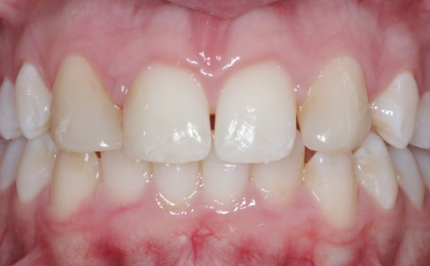 Before - The Campbell Clinic