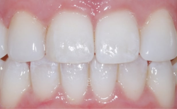 After -The Campbell Clinic