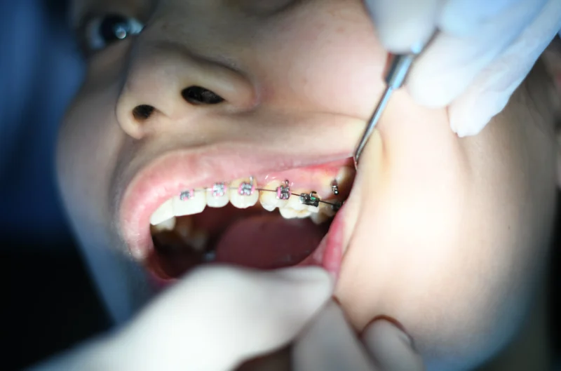 Blog - The Campbell Clinic